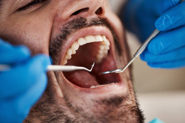 Best Broken Tooth Emergency  in Oakville, MO